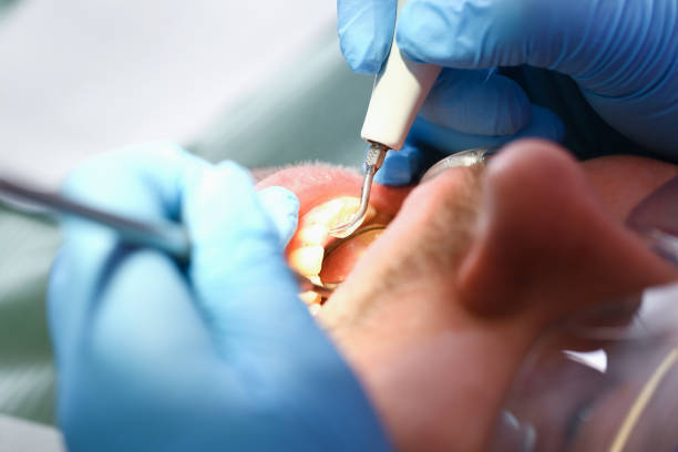 Best Walk-In Emergency Dentist in Gladeview, FL